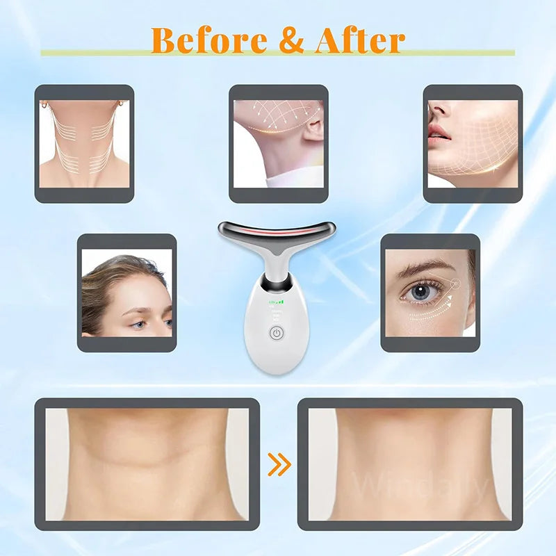 Youthful Glow Anti-Wrinkle Massager™