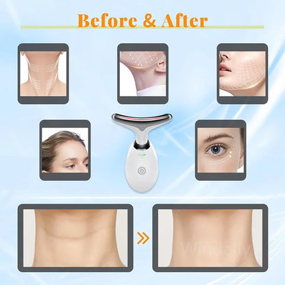 Youthful Glow Anti-Wrinkle Massager™